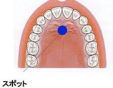 http://www.totani-dc.com/blog/photo/%E5%8F%A3%E8%88%8C.jpg