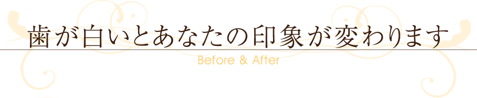 ～Before＆After～歯が白いとあなたの印象が変わります