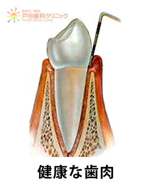 健康な歯肉.jpg