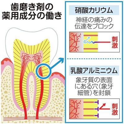 知覚過敏.jpg