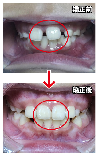 w_before_after1.jpg