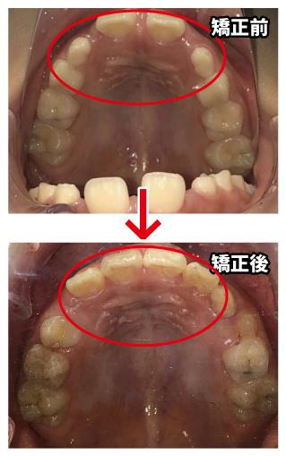 w_before_after3.jpg