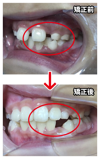 w_before_after5.jpg