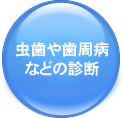 虫歯や歯周病などの診断