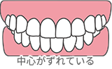 中心がずれている
