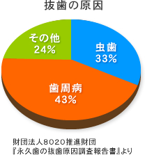 【抜歯の原因】虫歯33％、歯周病43％、その他24％（財団法人８０２０推進財団『永久歯の抜歯原因調査報告書』より）