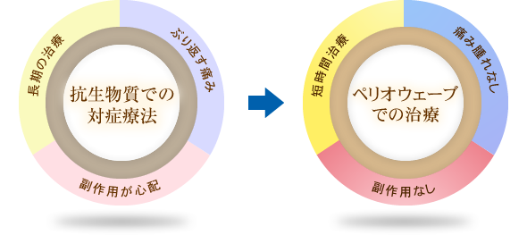 抗生物質での対症療法（ぶり返す痛み・副作用が心配・長期の治療）→ペリオウェーブでの治療（痛み腫れなし・副作用なし・短時間治療）