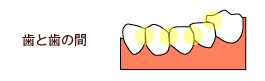 歯と歯の間