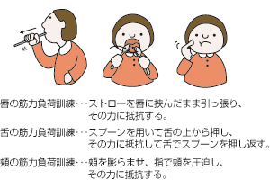 唇の負荷訓練…ストローを唇に挟んだまま引っ張り、その力に抵抗する。｜舌の筋力負荷訓練…スプーンを用いて舌の上から押し、その力に抵抗して舌でスプーンを押し返す。｜頬の筋力負荷訓練…頬を膨らませ、指で頬を圧迫し、その力に抵抗する。