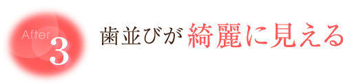 【After3】歯並びが綺麗に見える