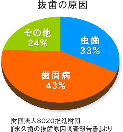 【抜歯の原因】虫歯33％、歯周病43％、その他24％（財団法人８０２０推進財団『永久歯の抜歯原因調査報告書』より）