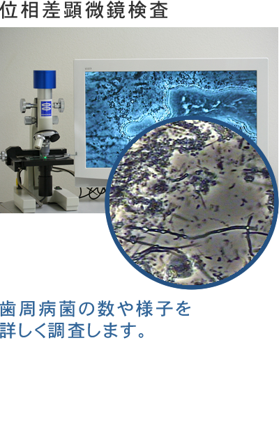 位相差顕微鏡検査（歯周病菌の数や様子を詳しく調査します。）