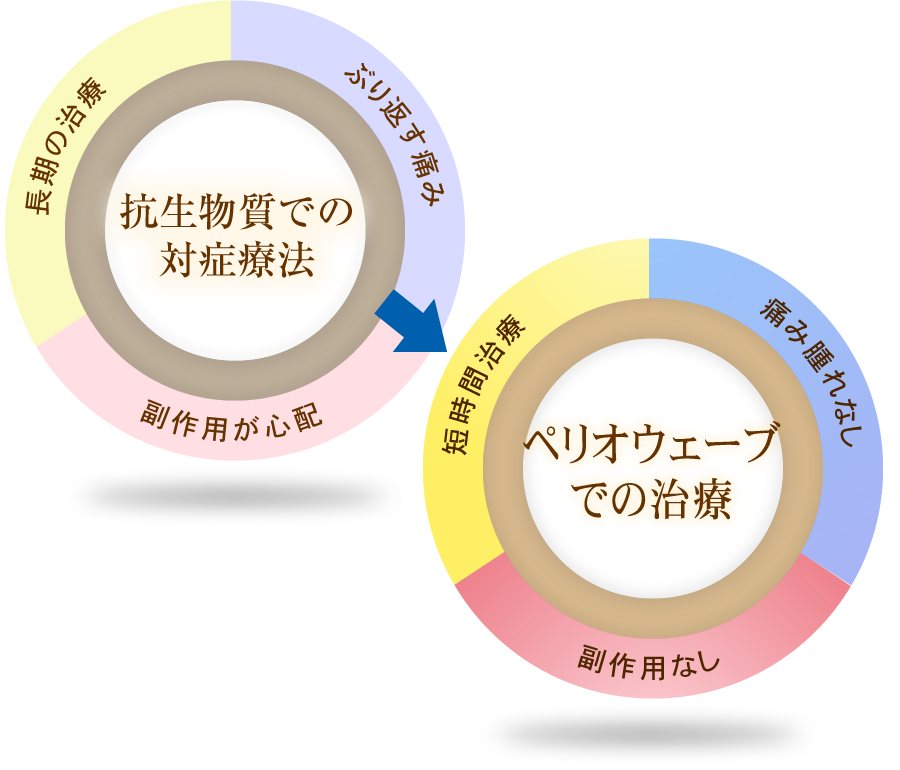 抗生物質での対症療法（ぶり返す痛み・副作用が心配・長期の治療）→ペリオウェーブでの治療（痛み腫れなし・副作用なし・短時間治療）